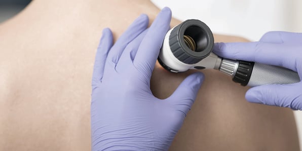 Dermatology Practices: OIG Eyes Modifier 25 & Skin Substitutes - White Paper