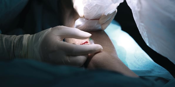 Understanding OIG’s Focus on Peripheral Vascular Procedure Trends - Webinar